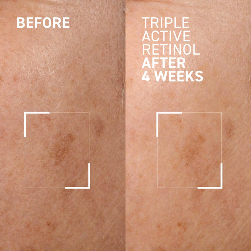 Dr. Brandt Triple Active Retinol Gentle Overnight Renewal Cream