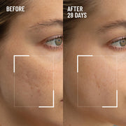 Dr. Brandt Microdermabrasion Renewing Face Exfoliator