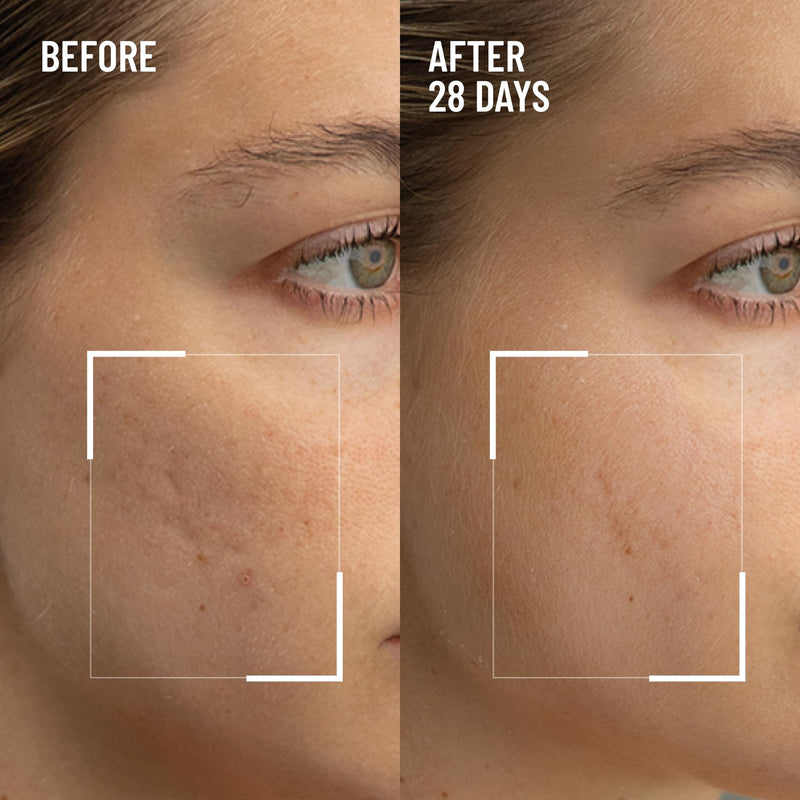 Dr. Brandt Microdermabrasion Renewing Face Exfoliator