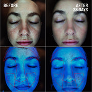 Dr. Brandt Microdermabrasion Renewing Face Exfoliator