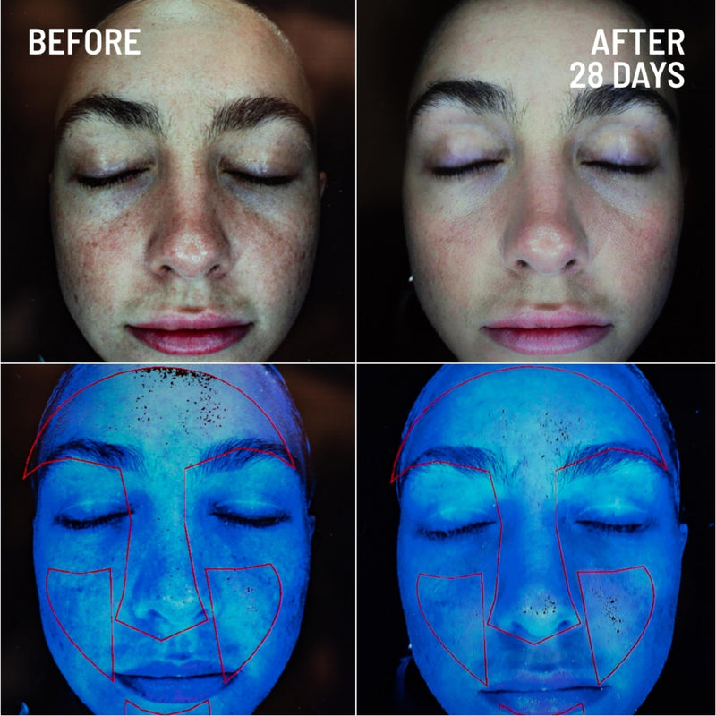 Dr. Brandt Microdermabrasion Renewing Face Exfoliator