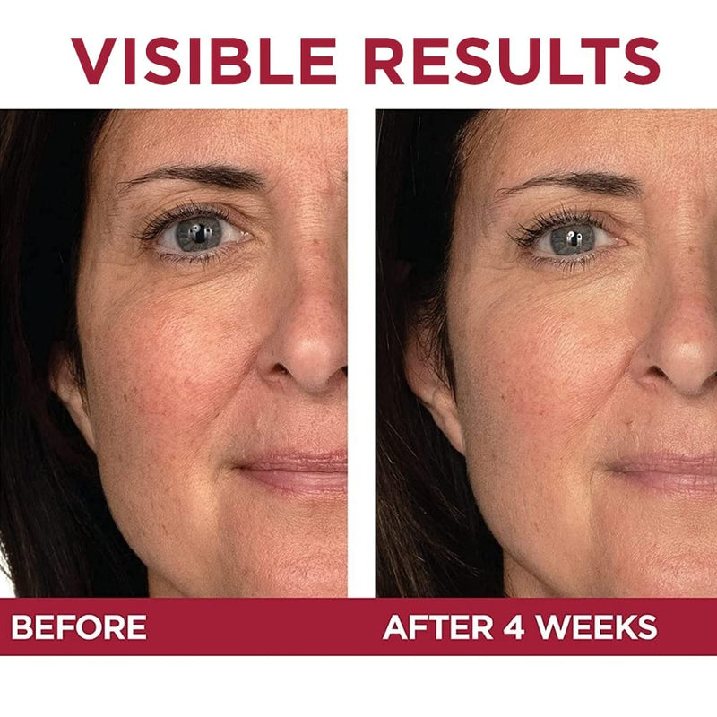 L'Oreal Revitalift Triple Power
